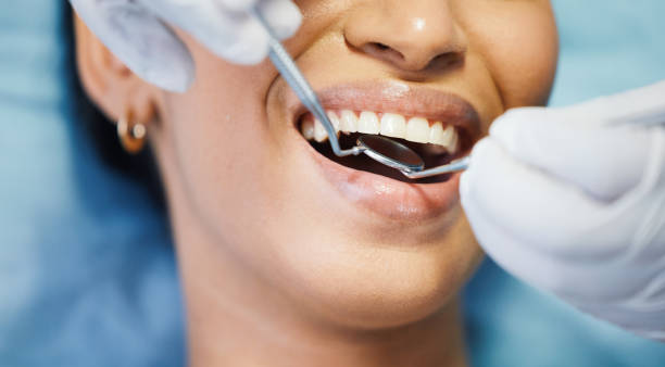 Best Broken or Cracked Tooth Emergency Dentist in Towaco, NJ