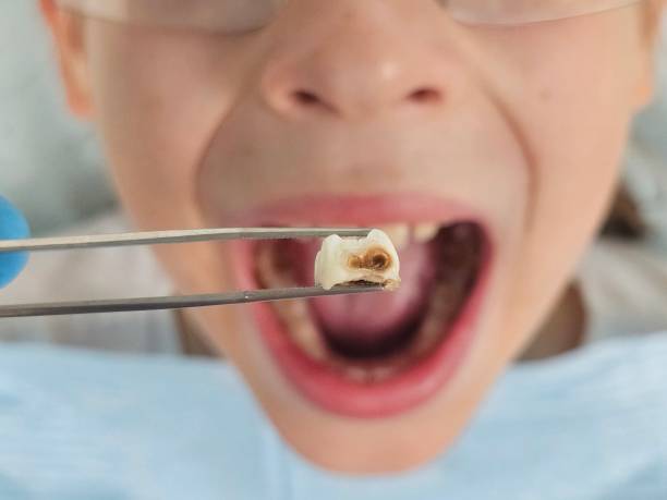 Best Emergency Dentist for Knocked-Out Tooth in Towaco, NJ